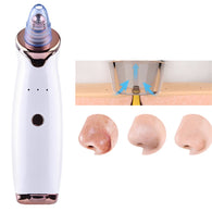 HopWop Electric Blackhead Remover
