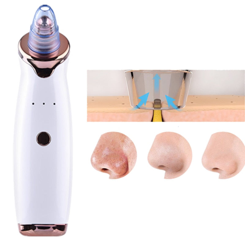 HopWop Electric Blackhead Remover